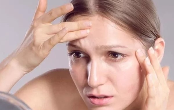 額頭上有皺紋怎么辦-額頭上有皺紋如何解決