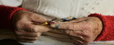 怎么預防老年斑