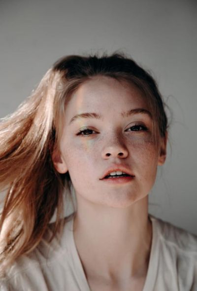 曬斑怎么去除掉