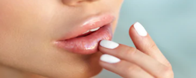 嘴唇干裂起皮怎么辦