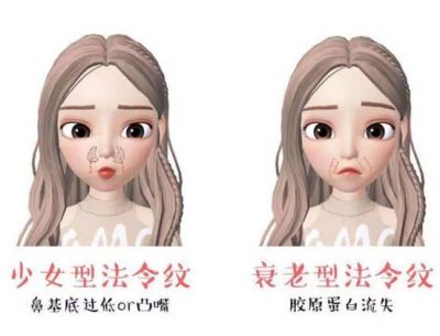 為什么年紀小就有法令紋