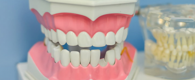 美白牙齒的方法