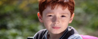 0108372311308 怎么去老年斑