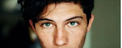 如何改善臉上的紅血絲