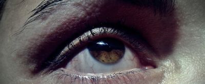 眼皮松弛了怎么辦