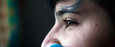 眼皮松弛了怎么辦