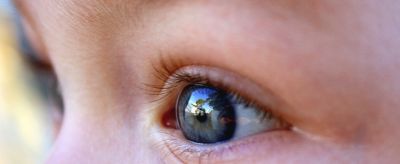 眼皮松弛了怎么辦