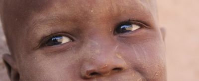 臉上起皮是怎么回事