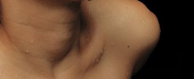 怎么去脖子上的皺紋