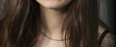 怎么去脖子上的皺紋