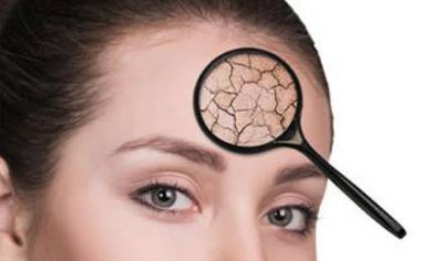 額頭皮膚特別粗糙怎么辦