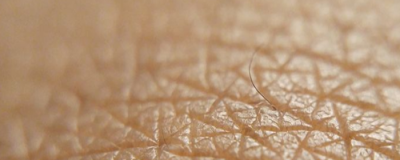 怎么去痘最有效