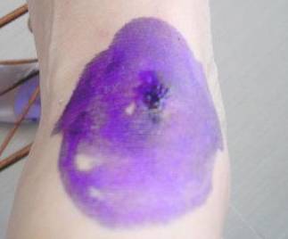 長期擦紫草油的危害