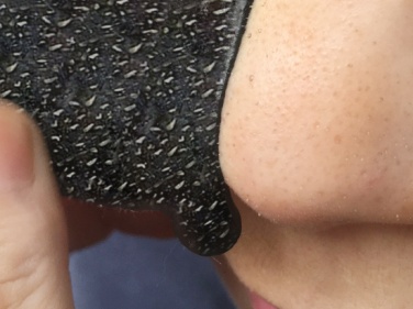 蘇打粉能去黑頭是真的嗎