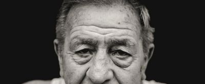 怎樣去除臉上老年斑