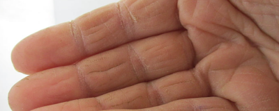 皮膚暗沉要怎么改善