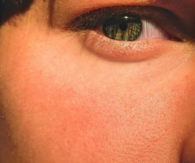 油性皮膚的特征