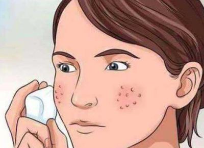 青春期最簡單的收縮毛孔方法