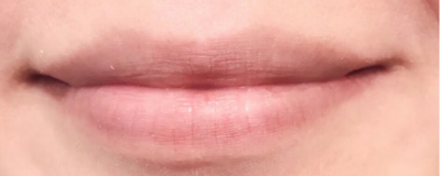 什么時候需要護唇