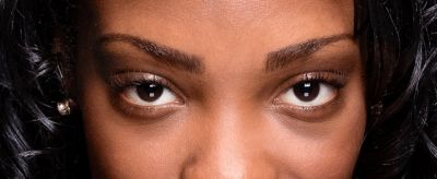 黑眼圈和眼袋的區別