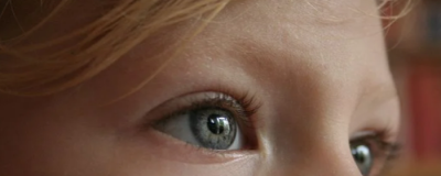 額頭皺紋多怎么辦