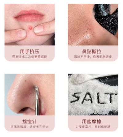 擠黑頭擠出來的白色東西是什么