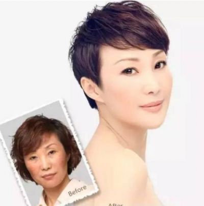 VDU醫用修復貼效果好嗎