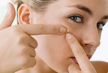 痘痘肌用什么護膚品對皮膚好