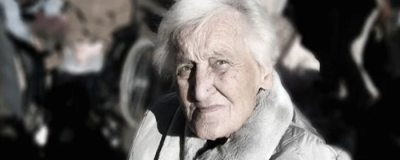 臉上的斑怎么能去掉