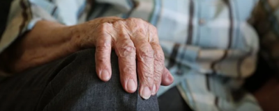 1336425711308 黃褐斑是什么原因引起的