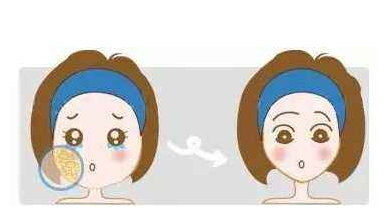 打完溶脂針注意事項