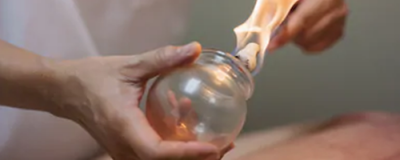 拔罐減肥反彈嗎