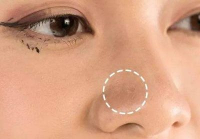 1438587911311 毛孔粗大怎么化妝不卡粉