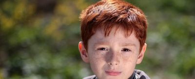 黃褐斑能自己消退嗎