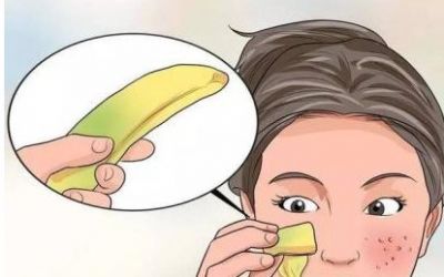 香蕉皮可以擦臉上可以祛斑嗎