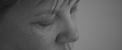 皮膚干燥起皮怎么辦