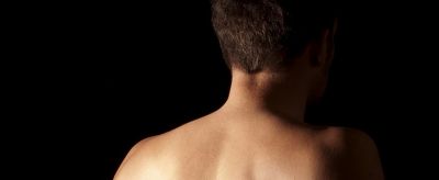 后背長痤瘡怎么辦