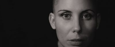 1633326411310 怎么預防色斑