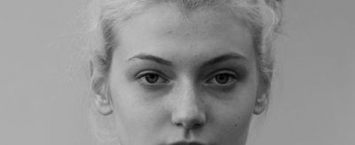 左下巴長痘痘是什么原因