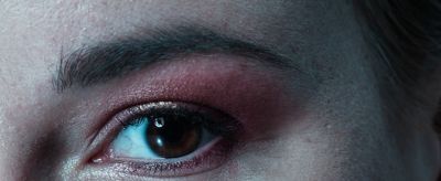 怎樣快速去除眼角紋