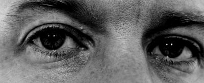 怎樣快速去除眼角紋