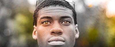 1654359311310 皮膚黑怎么辦