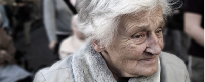 臉上的老人斑怎么去除