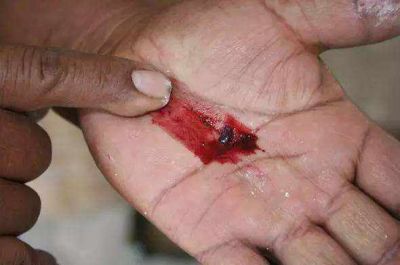 口紅里面真的有蟲子嗎