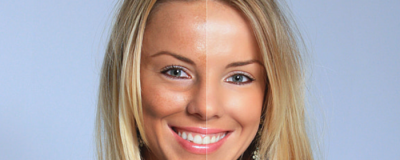 收縮毛孔的方法有什么