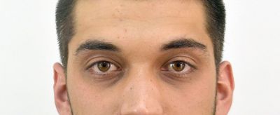 眉毛剃了多久會長出來