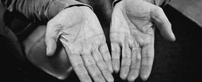 手皮膚發黃是什么原因