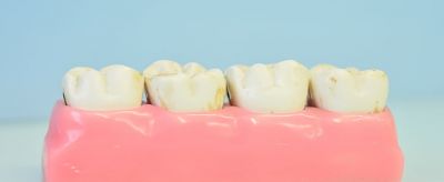 簡單美白牙齒方法