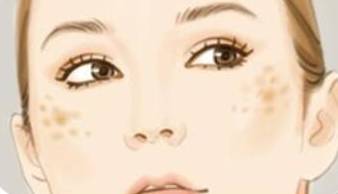 曬斑圖片怎么去除