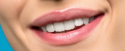 佳潔士美白牙貼禁忌